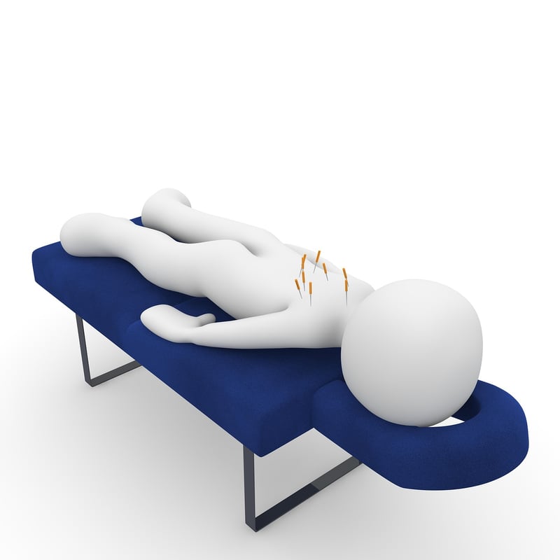 Acupuncture Needles